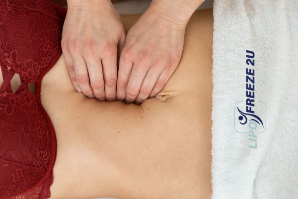 diastasis recti treatment West Hampstead