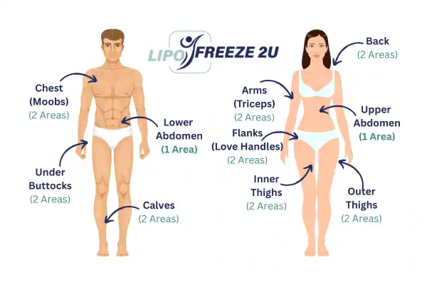 Areas you can have fat freezing treatment West Hampstead