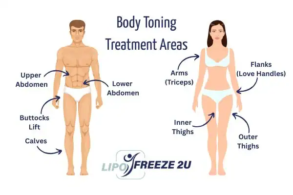 Graphic showing where you can have Body toning Treatment West Hampstead on your body