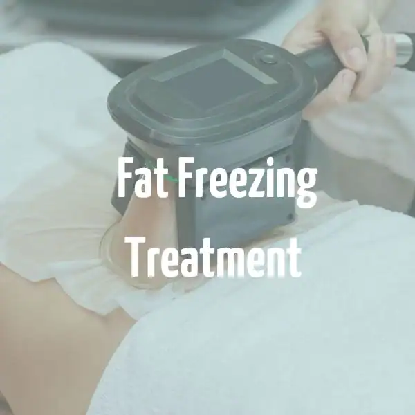 fat freezing treatment West Hampstead