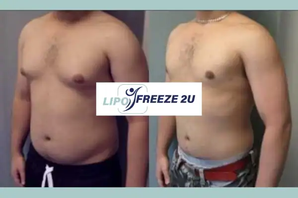 How Long Does It Take to See Results West Hampstead?