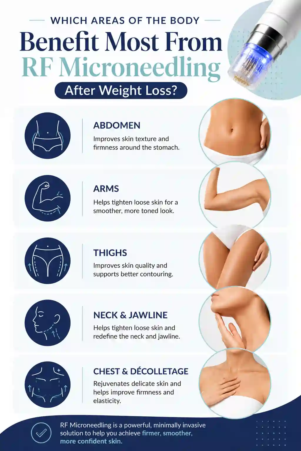 Which Areas of the Body Benefit Most From RF Microneedling After Weight Loss West Hampstead